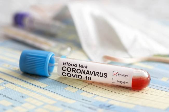 Comenzó la aplicación de la segunda dosis de vacunación contra el Coronavirus