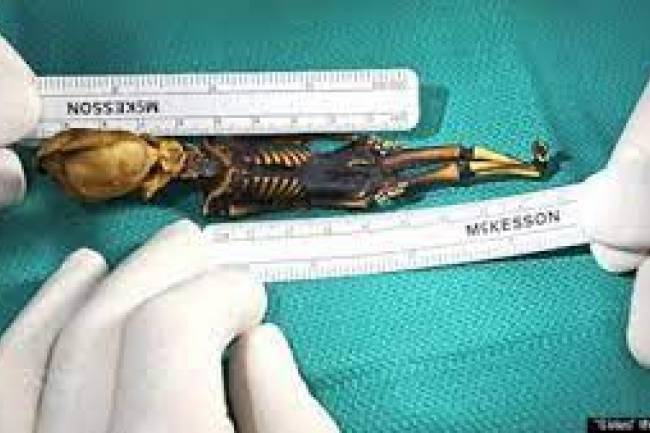 Esqueleto extraterrestre o humano mutante?