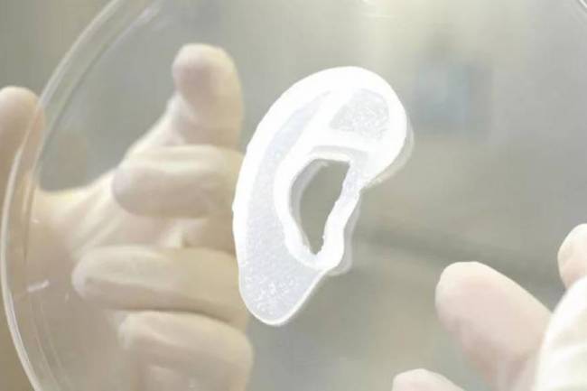 Gran Hazaña médica: Implantan con éxito una oreja impresa creada con células humanas