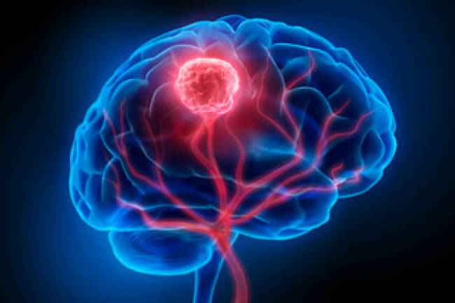 Los científicos matan el cáncer de cerebro con terapia cuántica por primera vez