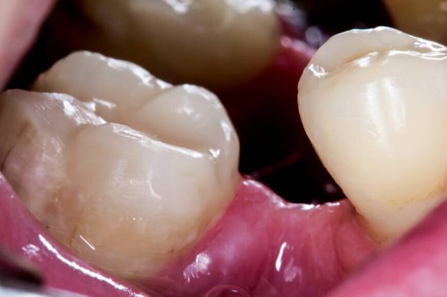 Empresa japonesa desarrolla fármaco para hacer crecer nuevos dientes y estiman que estará listo para 2024