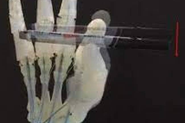 Robots impresos con huesos, ligamentos y tendones
