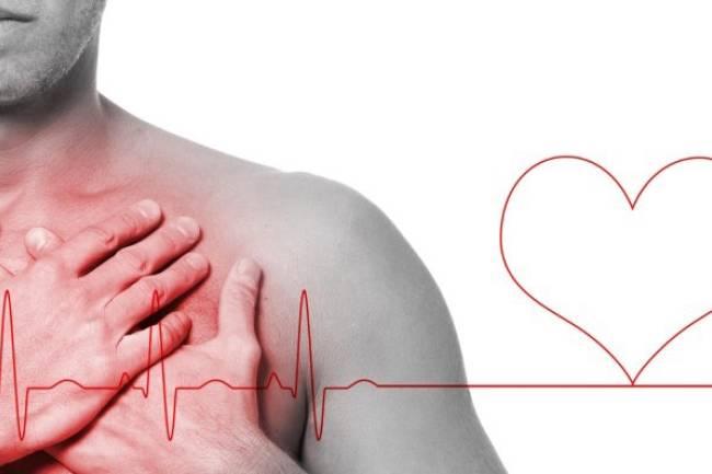 La Disección Aórtica: Una enfermedad rara del corazón