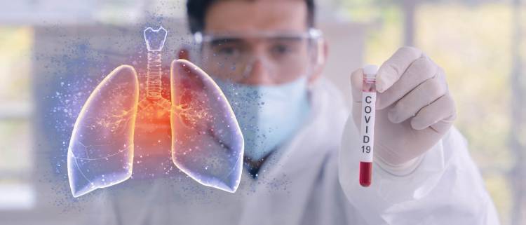 Creció 87% en dos semanas la cantidad de departamentos con alto riesgo epidemiológico en Argentina