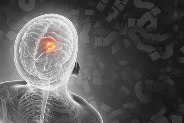 El modelo de IA puede ayudar a determinar dónde surgió el cáncer de un paciente