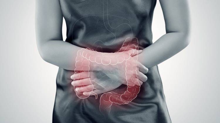 Una terapia para reducir el colesterol contribuiría a  prevenir un tipo agresivo de tumor colorrectal 