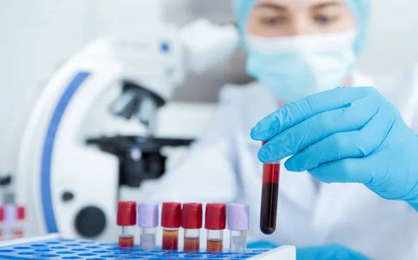 Una innovadora herramienta posibilitará la detección precoz del cáncer con extracciones de sangre más pequeñas